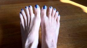 blue toenails