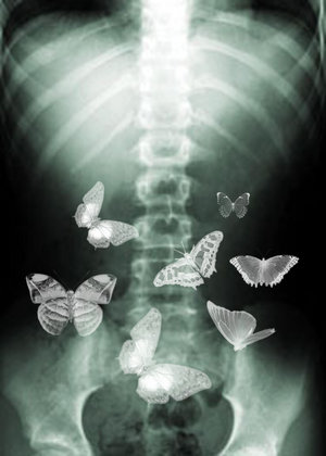 butterflies_in_my_stomach_by_bee_ee.jpg